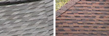 Shingles